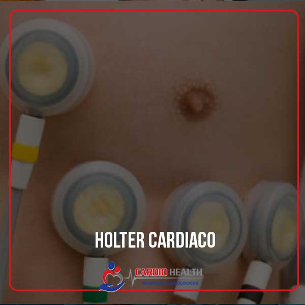 holter cardiaco