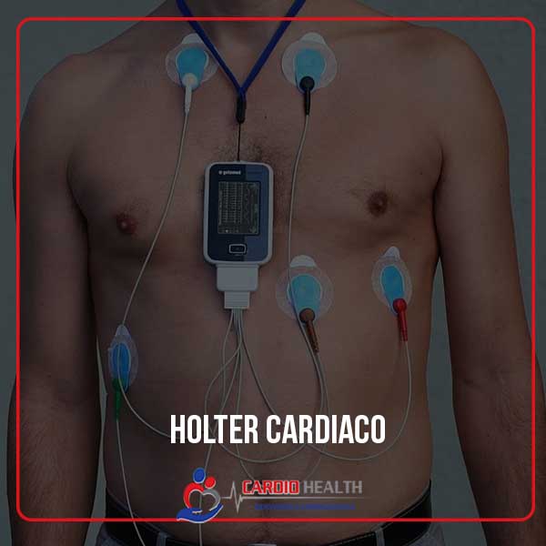 holter cardiaco